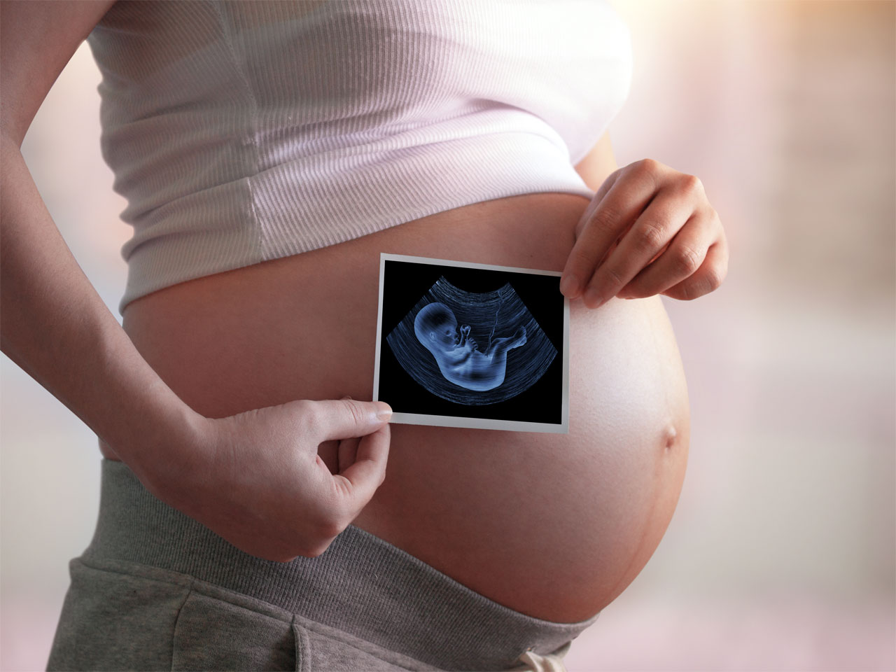 El diagn stico prenatal. Toda la seguridad para la madre y el beb